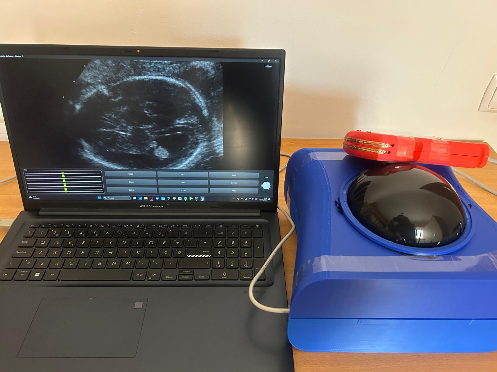 Protótipo PregnaScan